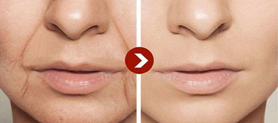 Anti wrinkle Anti wrinkle